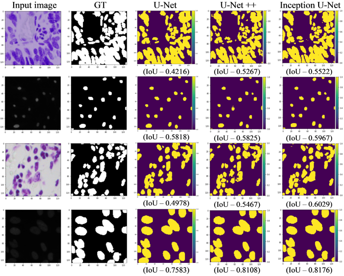 Inception U Net Architecture For Semantic Segmentation To Identify Nuclei In Microscopy Cell