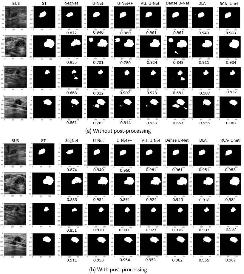 Segmentation results